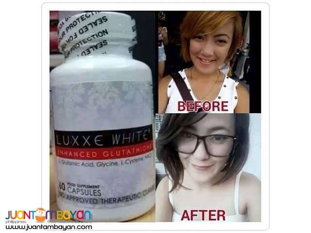 Most Effective Whitening Supplement in the Philippines