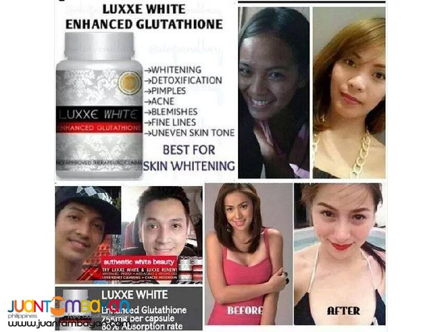 Best skin whitening and best seller in the market