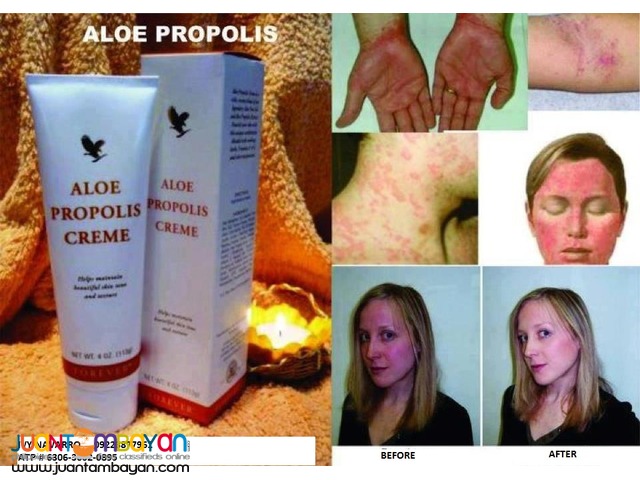 Aloe Propolis Cream for variety skin problems