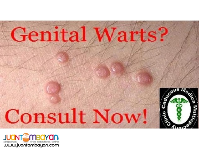 Genital Warts Removal Clinic in Quezon City