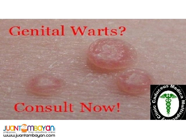 Genital Warts Removal Clinic in Quezon City