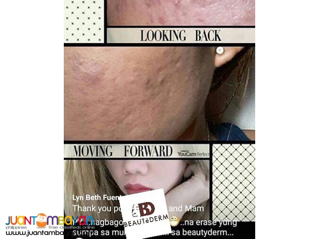 Beautederm Trial Set