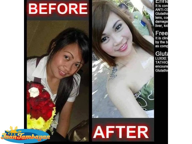 Luxxe White, Slim, Renew, Protect - Luxxe Products - Glutathione