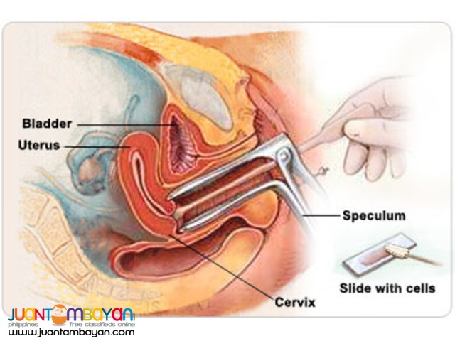 Pap Smear